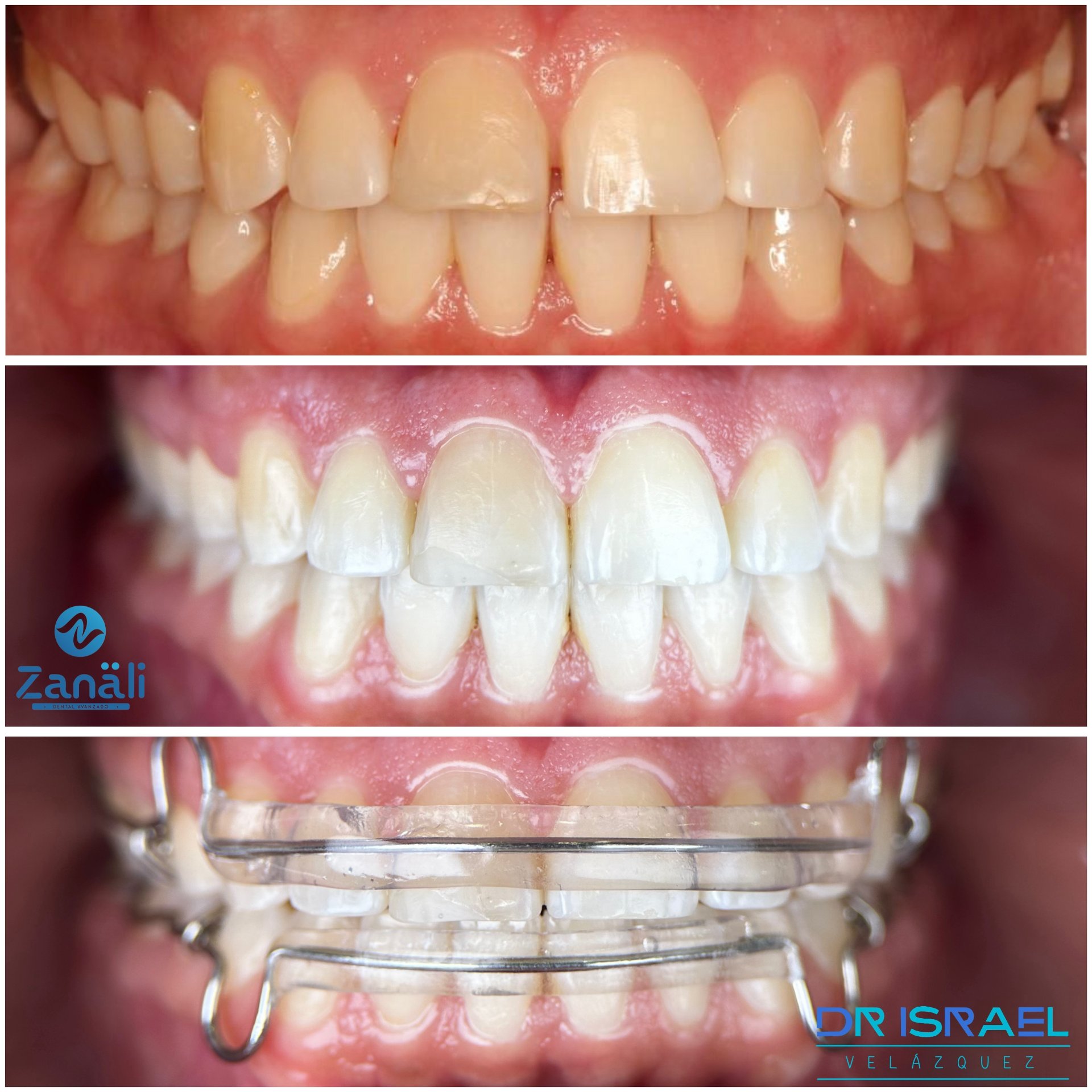 Recepción de Zanäli Dental Avanzado dentro de Soriana Híper Coapa