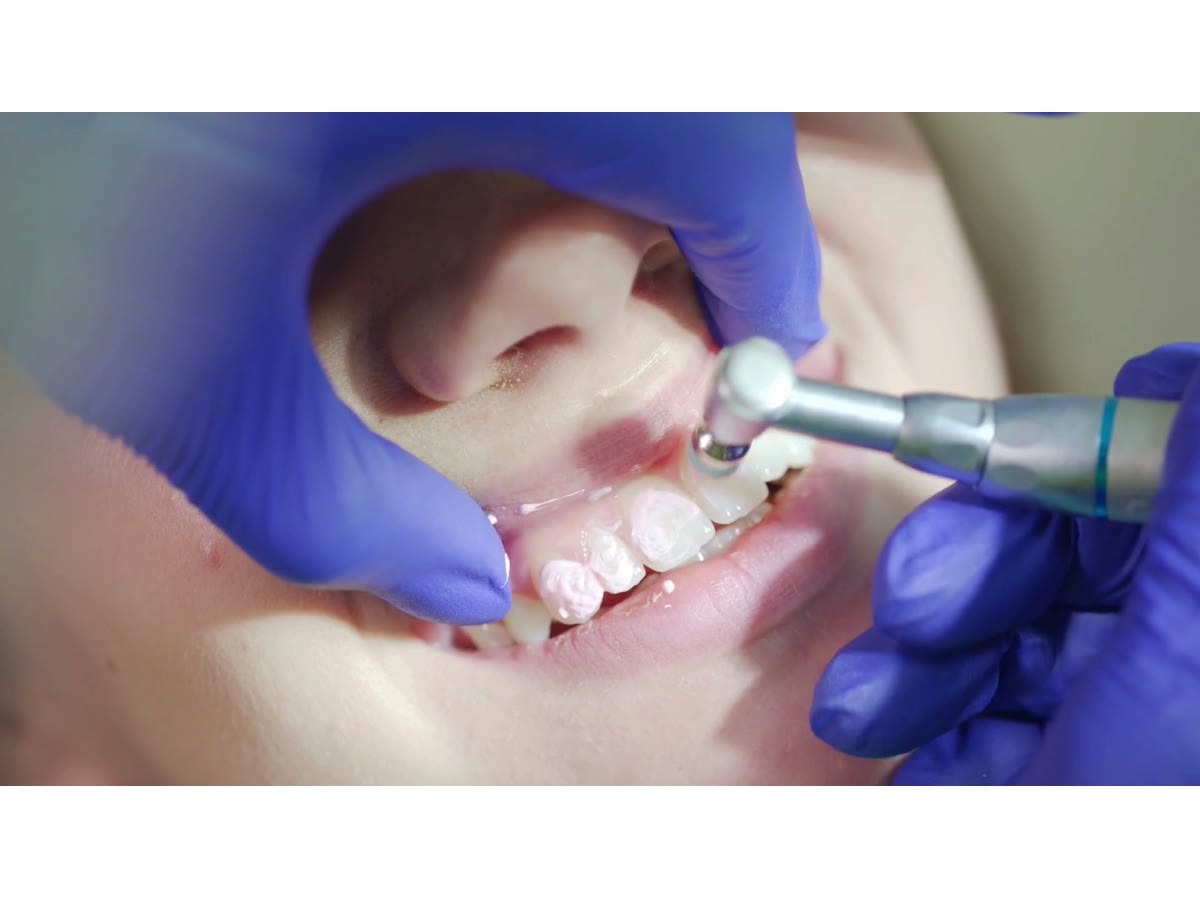 Atención dental en clínica con instrumental para el cuidado de los dientes.